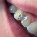 Curso Joyería Dental